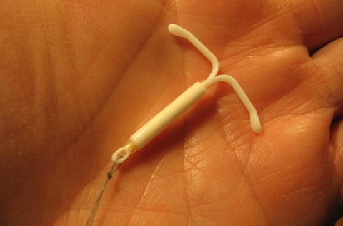 Установка внутриматочной спирали (контрацептива)